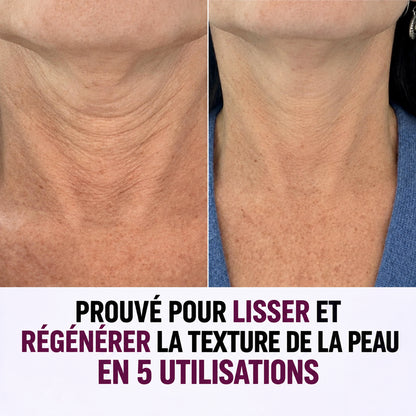 CIORA® Crème Cou Lissante & Repulpante